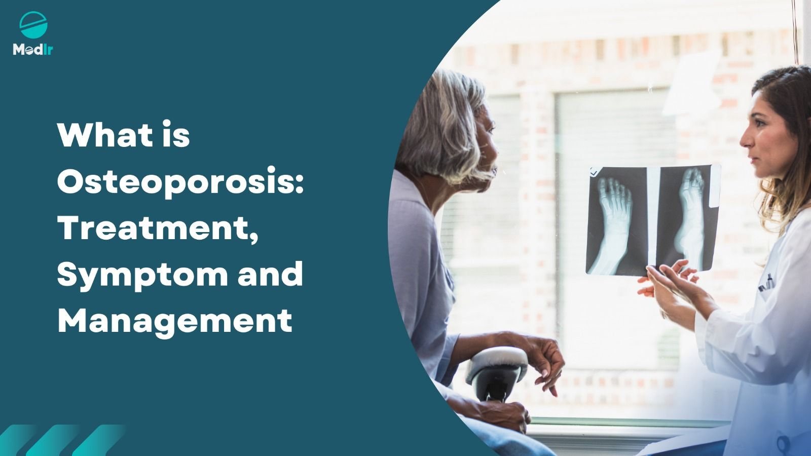 What is Osteoporosis: Treatment, Symptom, Management