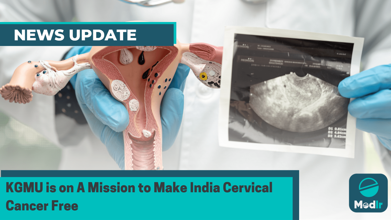 KGMU is on A Mission to Make India Cervical Cancer Free