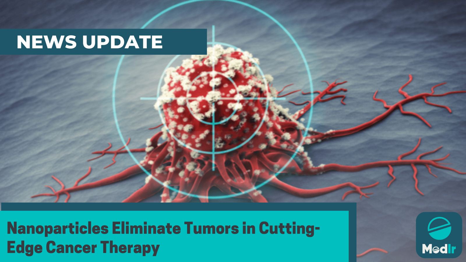 Nanoparticles Eliminate Tumors in Cutting-Edge Cancer Therapy