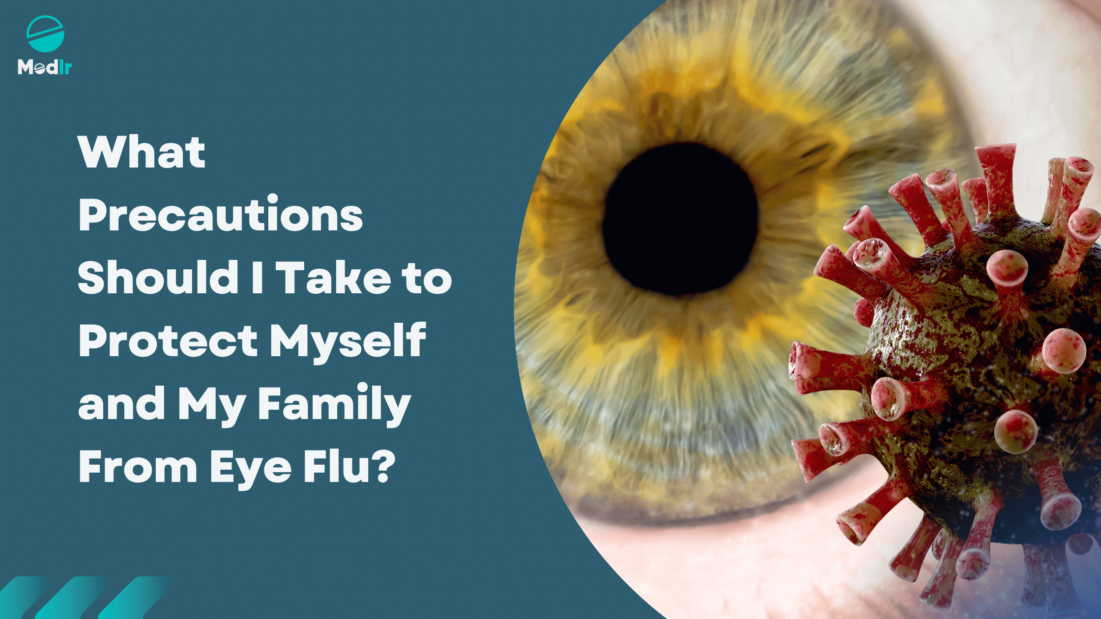 What Precautions Should I Take to Protect Myself and My Family From Eye Flu?