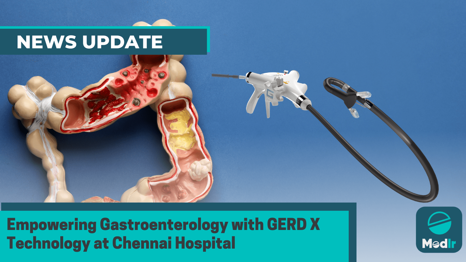 Empowering Gastroenterology with GERD X Technology at Chennai Hospital