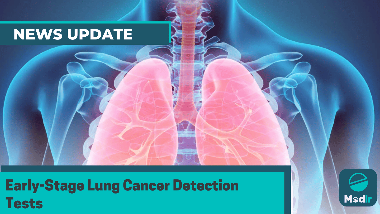 Early-Stage Lung Cancer Detection Tests