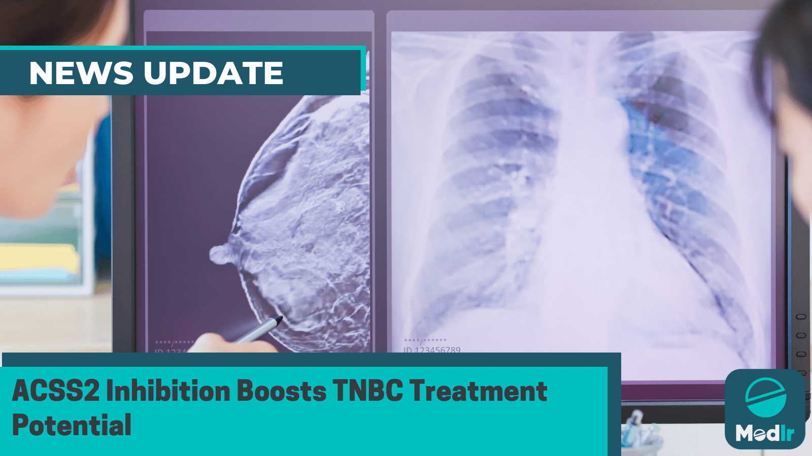 ACSS2 Inhibition Boosts TNBC Treatment Potential