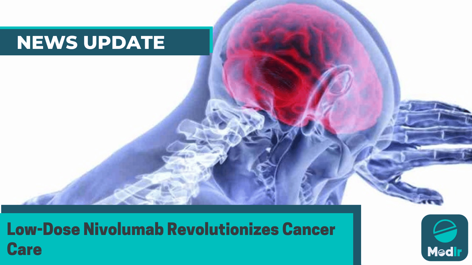 Low-Dose Nivolumab Revolutionizes Cancer Care