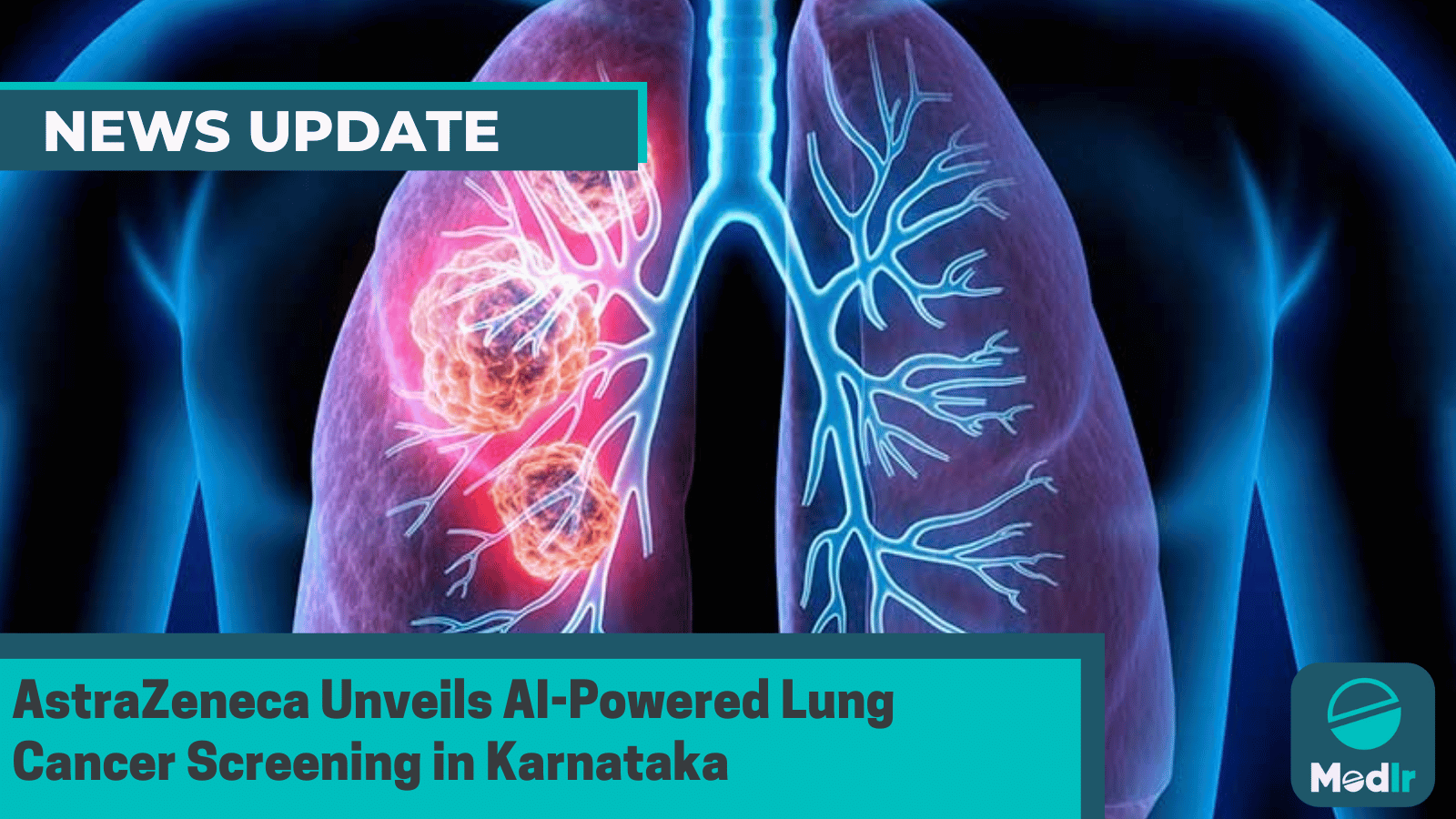 AstraZeneca Unveils AI-Powered Lung Cancer Screening in Karnataka