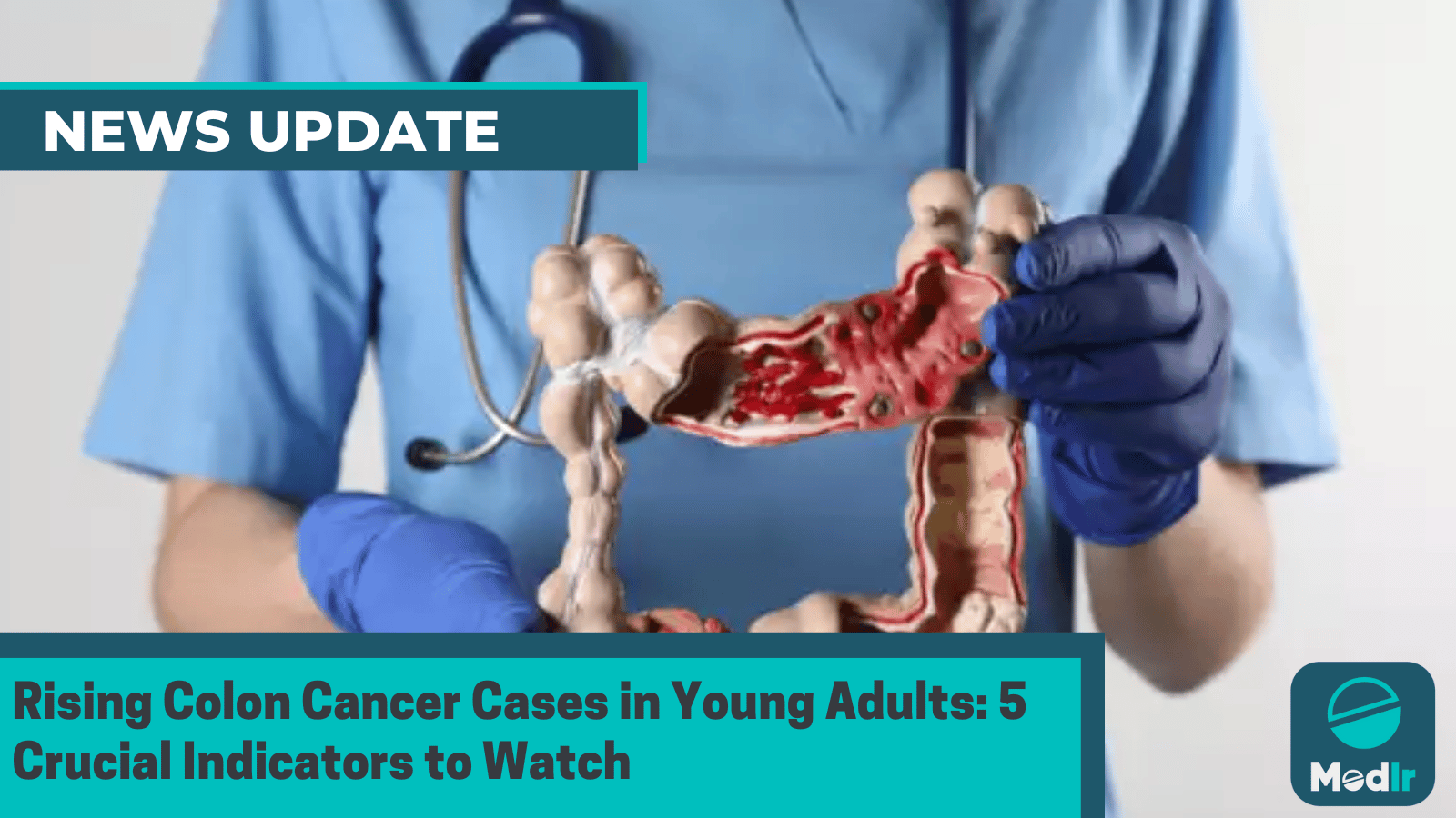 Rising Colon Cancer Cases in Young Adults: 5 Crucial Indicators to Watch