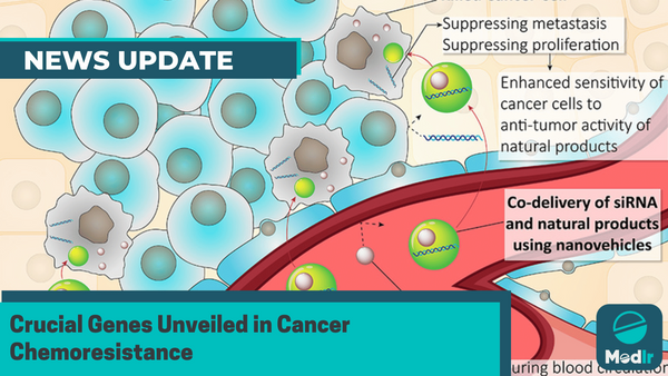 Crucial Genes Unveiled in Cancer Chemoresistance